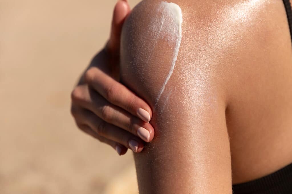 Woman putting on sunscreen to prevent sun damage to her skin.