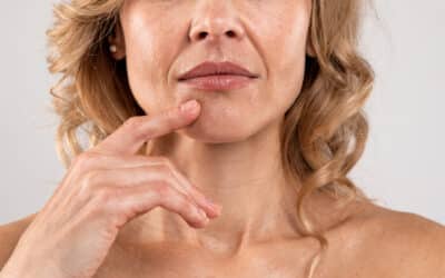 How to Get of Nasolabial Folds Without Filler or Surgery!